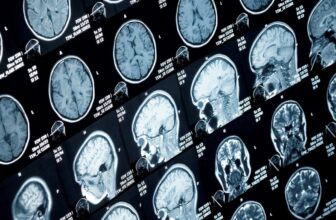 Main Research Discover No Proof of Mind Harm in Havana Syndrome Circumstances